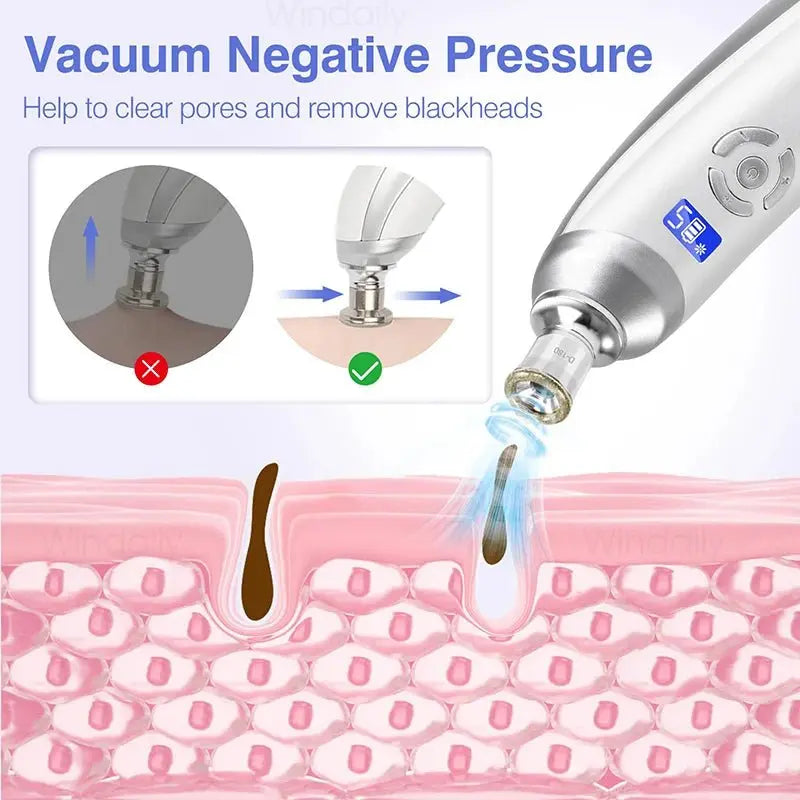 2025 Wireless Diamond Microdermabrasion Machine Blackhead Remover Vacuum Pore Cleaner Facial Skin Care Tool Face Beauty Device - HONORABLE VETERANS SOLUTIONS